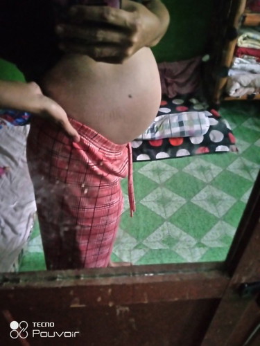 Pregnancy