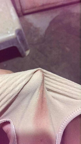 มีเลือดออกช่องคลอดท้องได้ 38 weeks 4 วันคะ