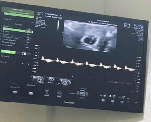 Jenis Kelamin Bayi