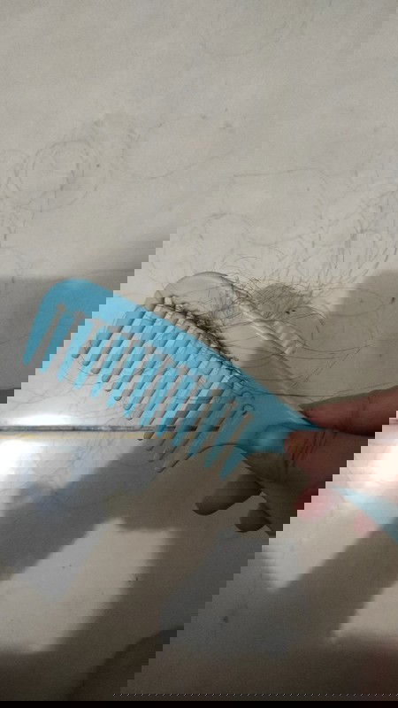 Rambut rontok pasca melahirkan/setelah menyusui