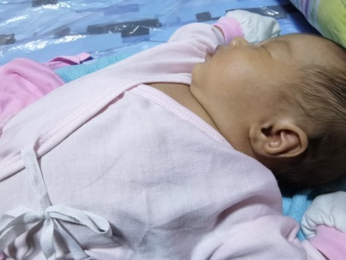 Gamot sa butlig/acne