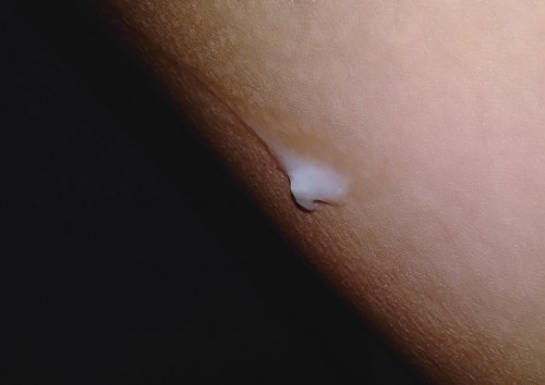 Kehamilan usia 36 week 5 hari