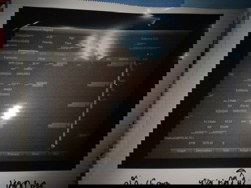 ช่วยบอกหน่อยค่ะไม่รู้จริงๆ ท้องแรกค่ะ