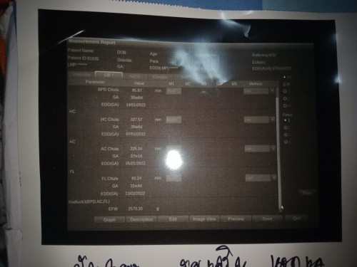 ช่วยบอกหน่อยค่ะไม่รู้จริงๆ ท้องแรกค่ะ