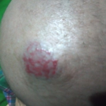 Halloo bunda bunda,,