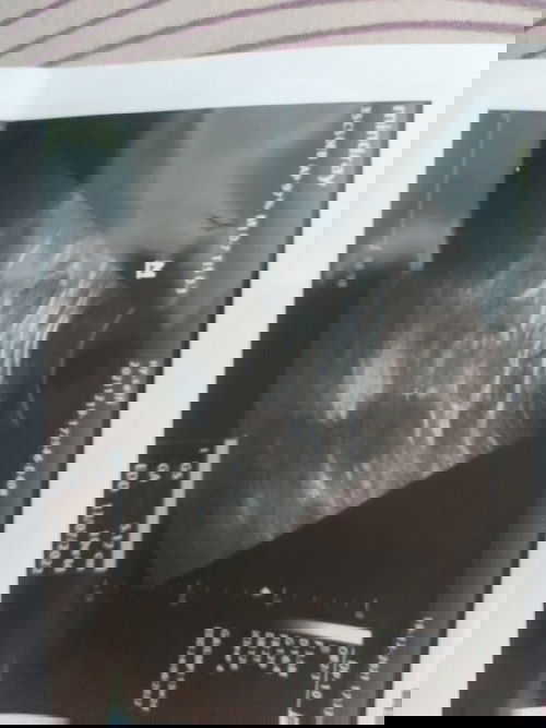 Hamil tapi masih keliatan kantongnya saja