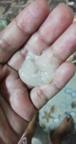 40+1ยังไม่คลอดมีมูกออกมา