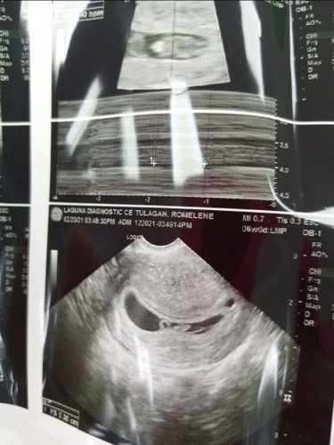 6weeks and 6 days