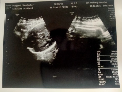 สงสัยเรื่องกำหนดคลอดค่ะ