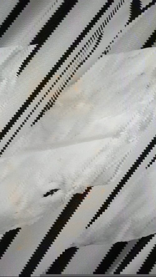 Keluar kecoklatan saat hamil 19 minggu