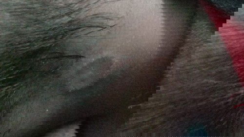 Ruam atau gigitan serangga ya ?