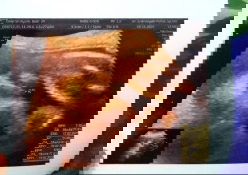 Ada yg sama gak kayak aku Bun?