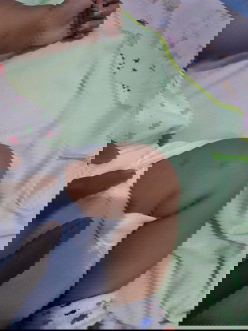 Bun obat untuk bayi buat menghilangkan bekas gigitan nyamuk/semut apa ya?