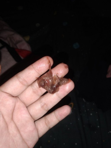 im 39 and 2 days weeks pregnant. ask kolang po normal lang poba to lumabas after ie 2cm napo ako