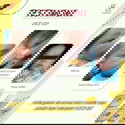 Bu Ibu.. yg babynya mengalami ruam popok dan beruntusan bisa coba pakai ini yaa..