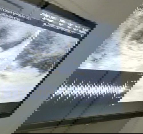 Bumil 8 minggu 3 hari