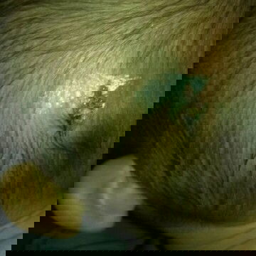 Benjolan bernanah di kepala