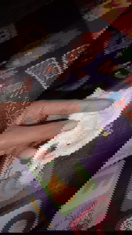 Flek coklat saat hamil trimester pertama