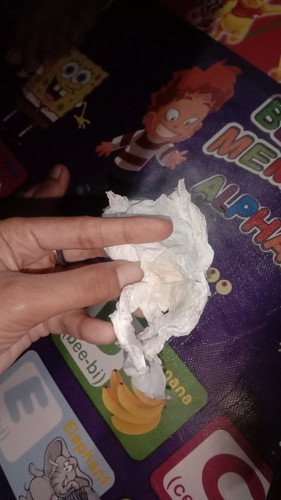 Flek coklat saat hamil trimester pertama