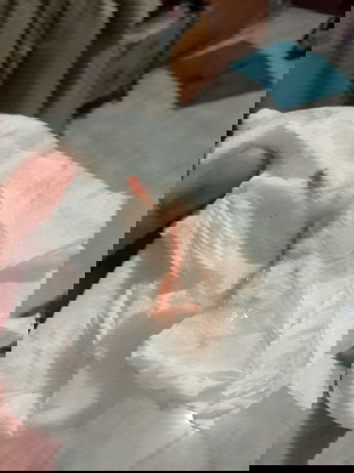 39+5 ใกล้หรือยังคะแบบนี้