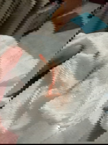 39+5 ใกล้หรือยังคะแบบนี้