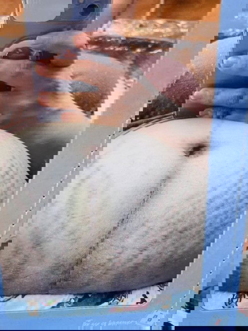 CS scar. 11 days PP. Hi mommies patuyo na po kaya etong tahi ko?