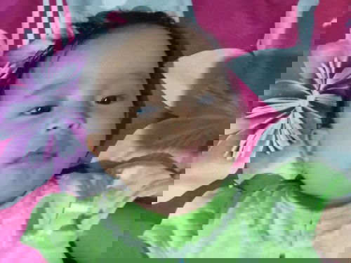 Pipi beruntusan merah