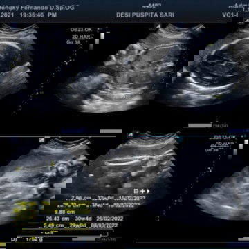 PLISS NANYA YG SEPENGALAMAN.. SHARE KE AKU!!