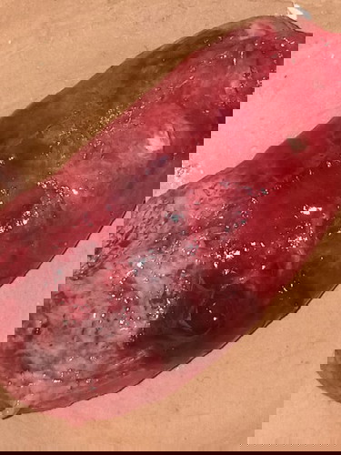 Keguguran di minggu 14week