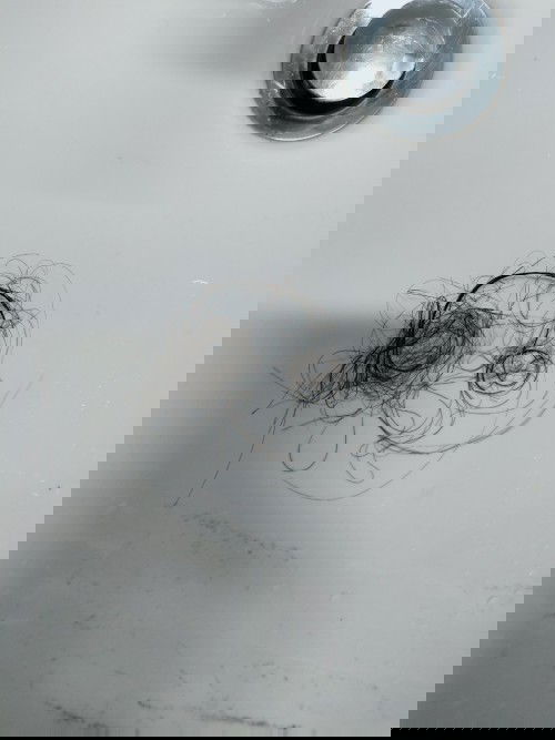 ผมร่วงเยอะ