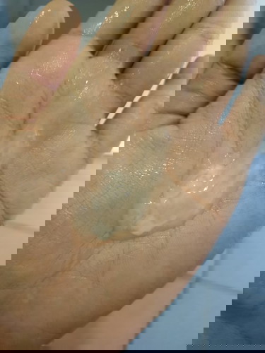 ควรไปหาหมอไหมค่ะ