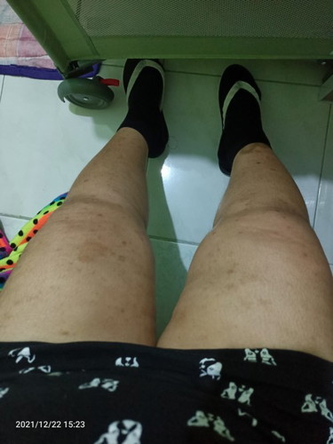 Concern about pamamanas ..
