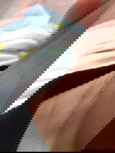 ลูกมีแผลที่คอควรทำยังงัยค่ะ