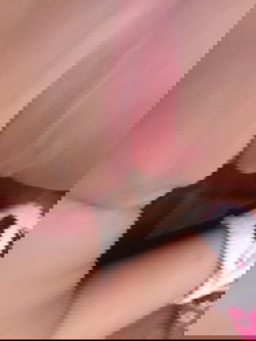 Ptp.. ano ppo ang mbsang gmot dto . Na try kna ang calmoseptine atska isng product ng zinc oxide