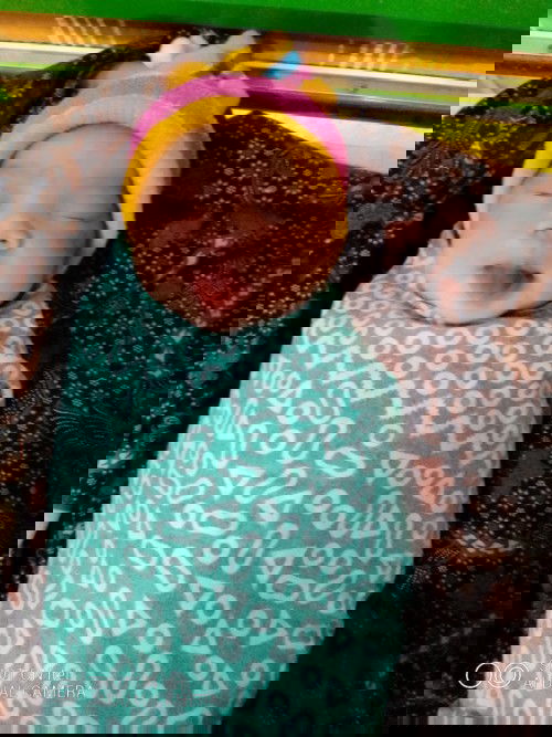 Kenapa yabun perut saya sakit banget setelah melahirkan.