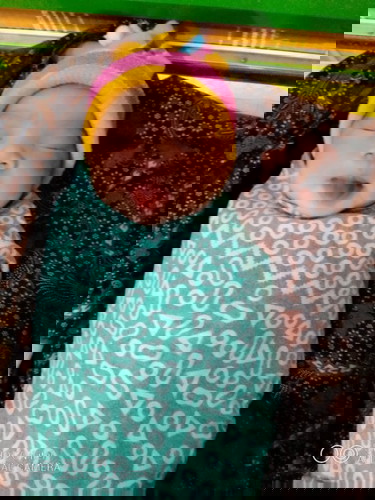 Kenapa yabun perut saya sakit banget setelah melahirkan.