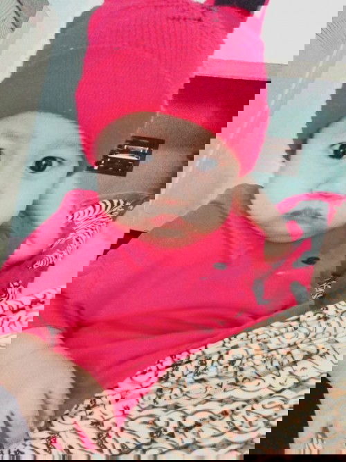 9 bulan belum bisa merangkak