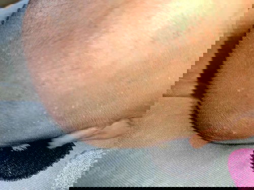 Bintik bintik di kepala, wajah dan badan