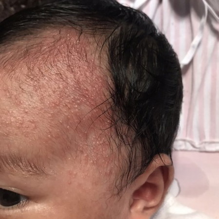 Hello po ano pong tawag dito? Ano pong pwedeng remedy?#pleasehelp #firstbaby