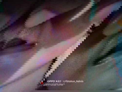 Masalah mulut pada bayi