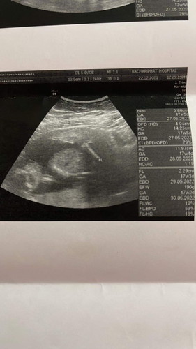 ขอสอบถามหน่อยนะคะ