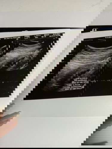 ðāļāđāļēāļ§āļāđāļ§āļð