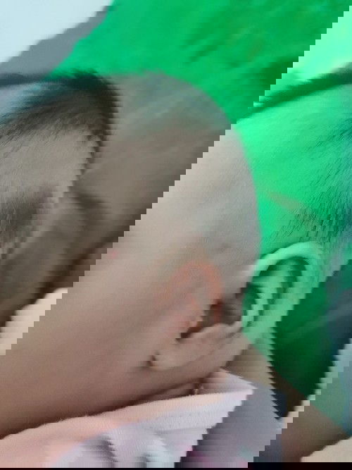 ผมขึ้นไม่หมด