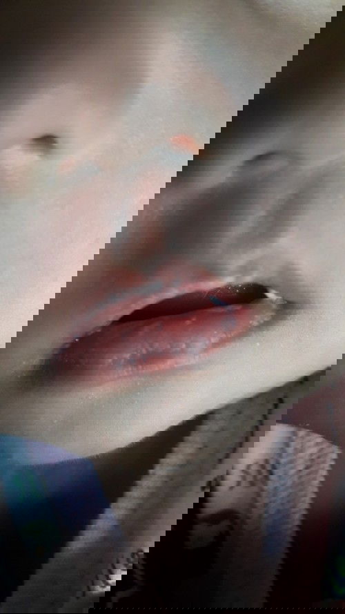 Putih putih di area bibir bayi