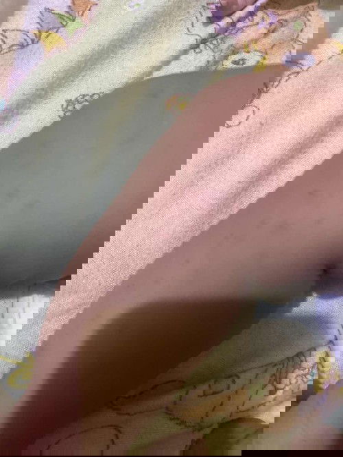 Bintik merah di kaki