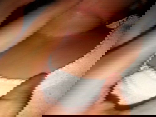 Biang keringat bikin ruam