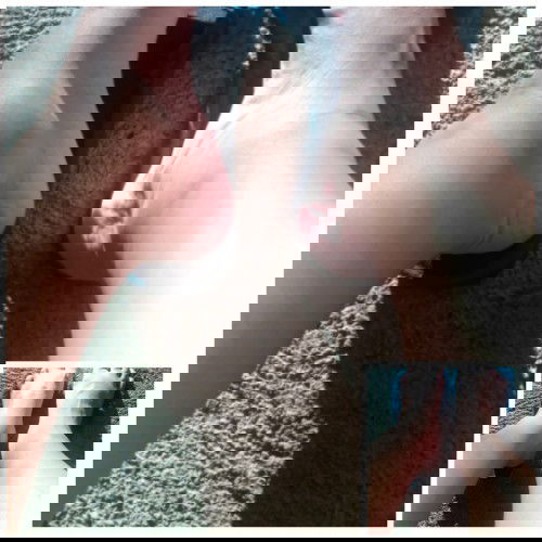 Manas sa paa at binti