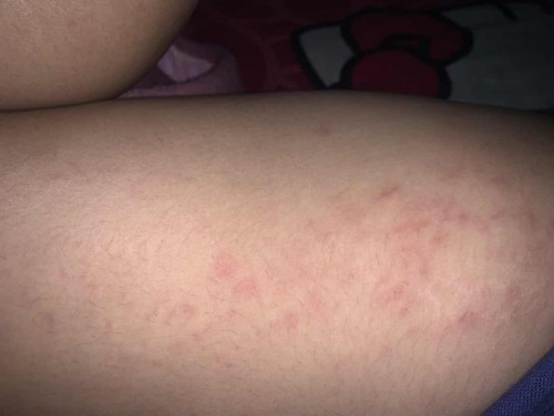 สอบถาม🙏🏻🙏🏻🙏🏻🙏🏻