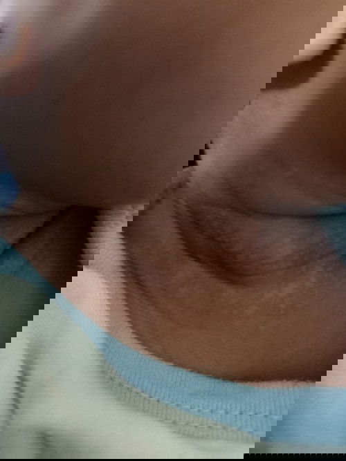 Leher bayik bintik-bintik