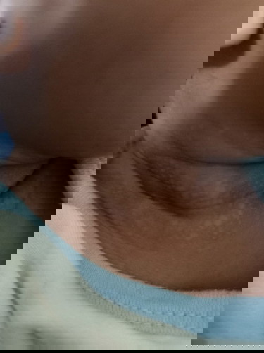 Leher bayik bintik-bintik